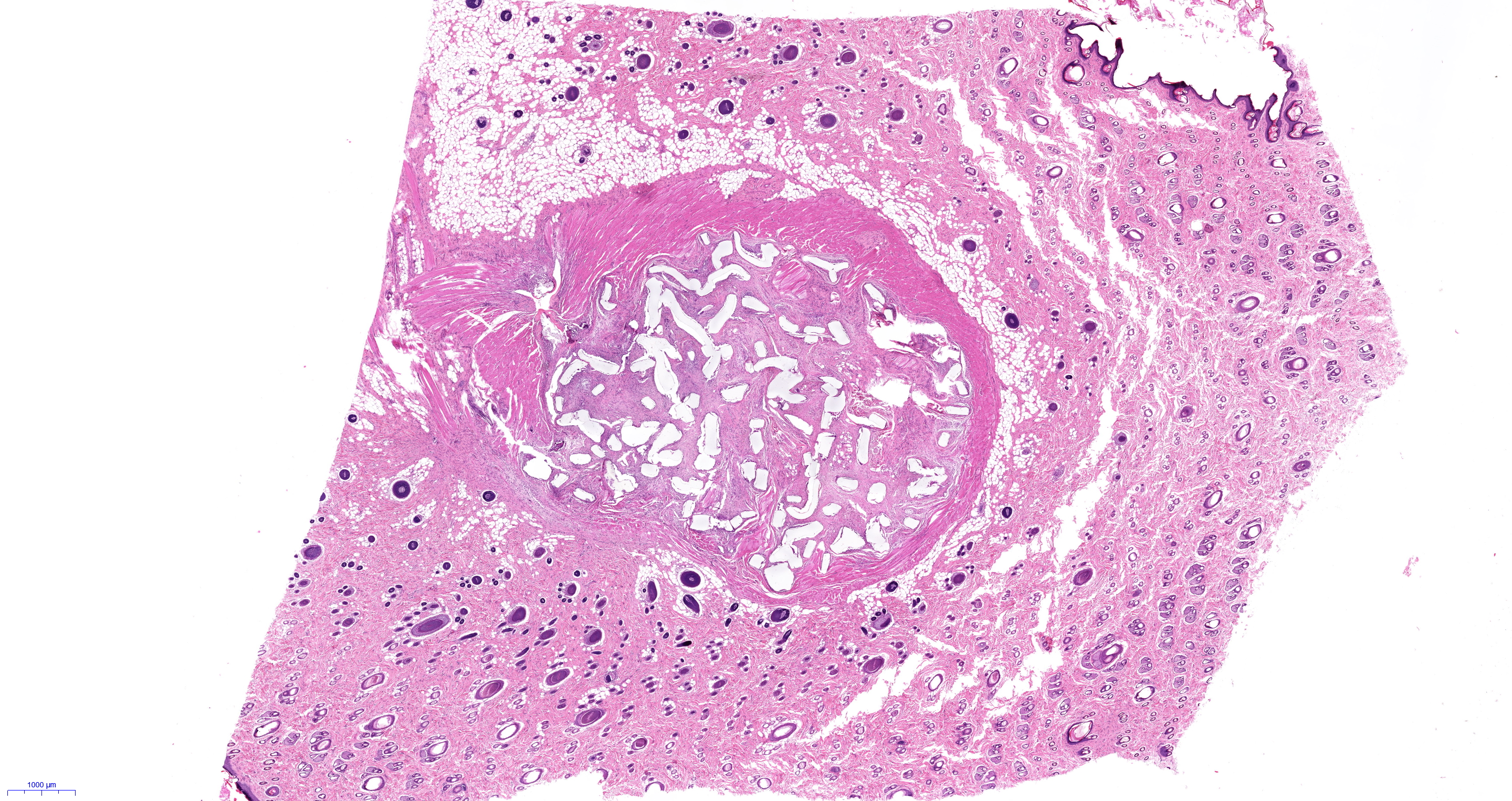 H&E section (stained with haematoxylin and eosin) of a highly porous StarPore® scaffold, implanted subcutaneously in a rat for 4 weeks showing extensive soft tissue ingrowth.
