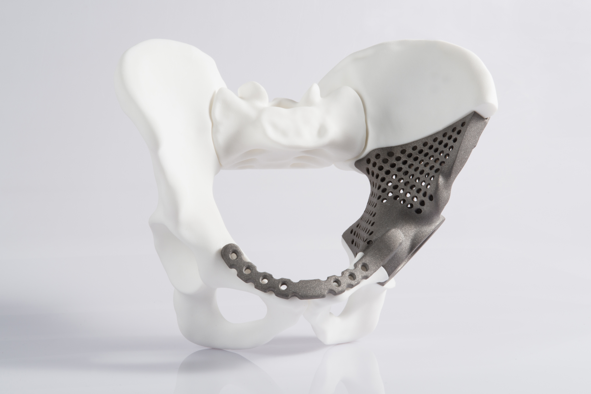 In the hip area, the precise shaping of the replacement bone is particularly important, so the implant had to be extremely correct.
