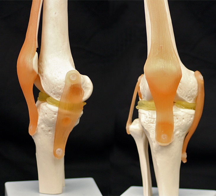 A cartilage-mimicking material created by researchers at Duke University may allow surgeons to 3D print meniscus implants or other replacement parts that are custom-shaped to each patient's anatomy. To demonstrate how it might work, the researchers used a $300 3D printer to create custom menisci for a model of a knee. Photo: Feichen Yang.